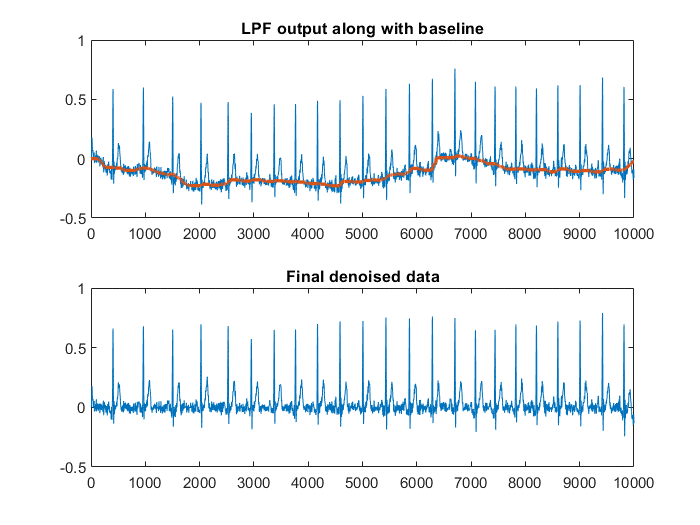 Filtered ECG waveform comparison